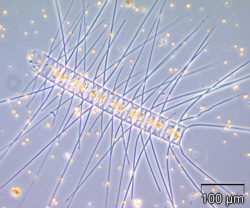 Busch: Chaetoceros decipiens, JPG-Graphik: 53 kb